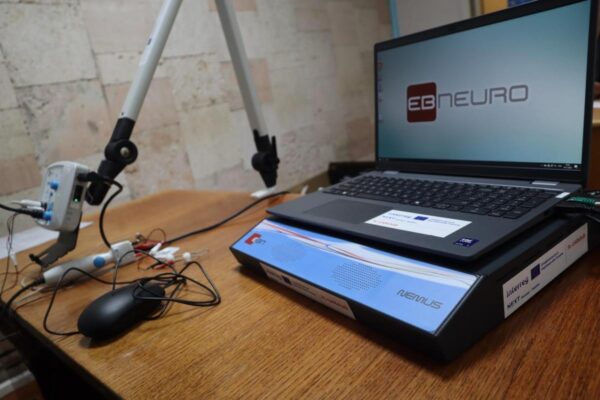 Рожищенська лікарня отримала сучасне діагностичне обладнання 