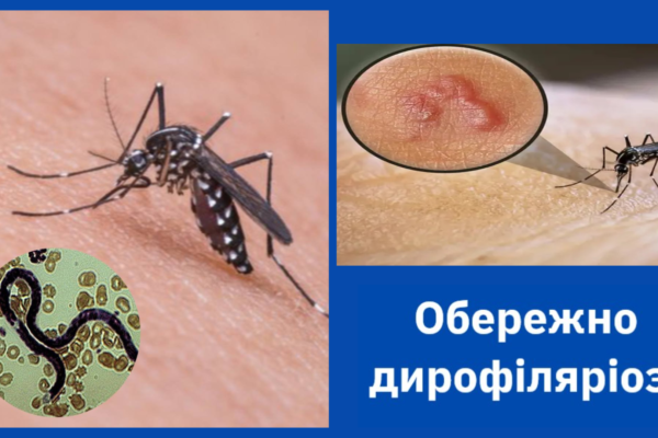 Відчувала рух під шкірою: на Волині підтверджено випадок дирофіляріозу 