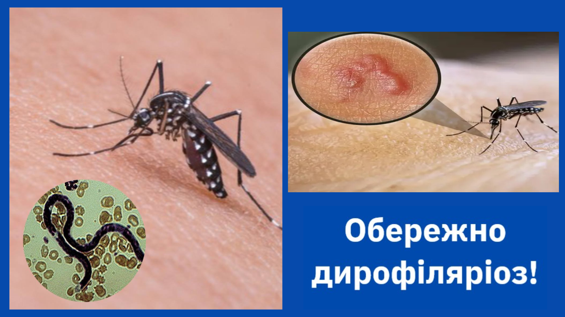 Відчувала рух під шкірою: на Волині підтверджено випадок дирофіляріозу 